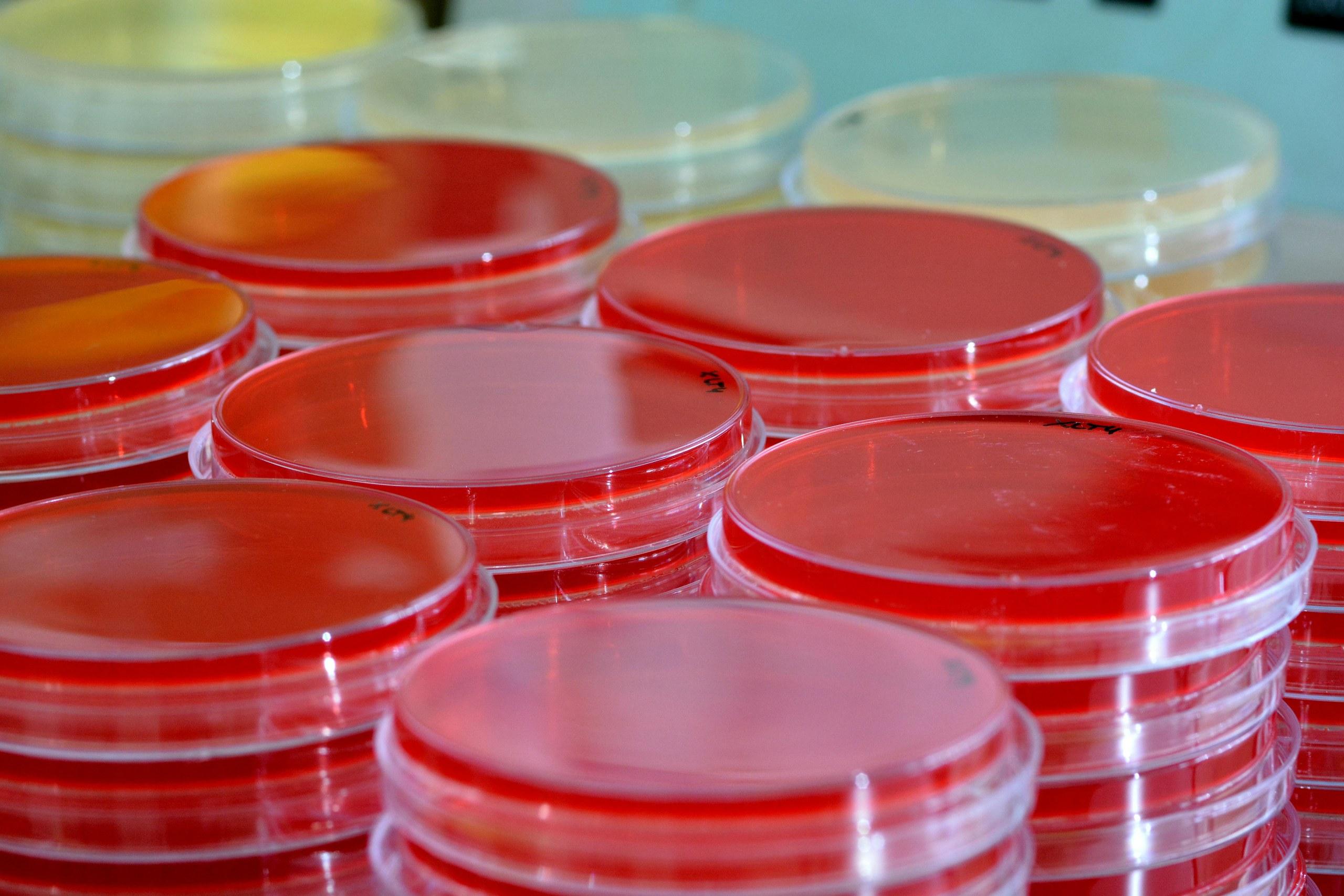 Hematoloji Nedir?